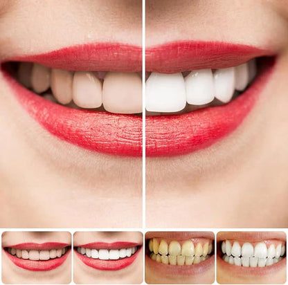 Probiotic   Ultra Whitening   Toothpaste